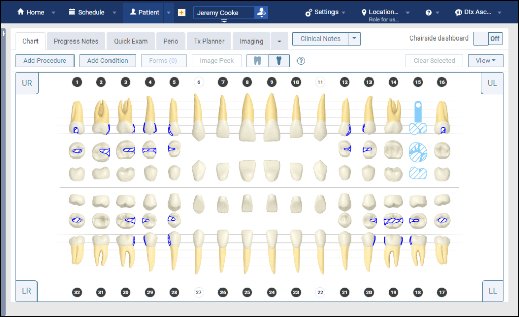 Seeing the Chart and the Perio Exam at the Same Time Dentrix Ascend