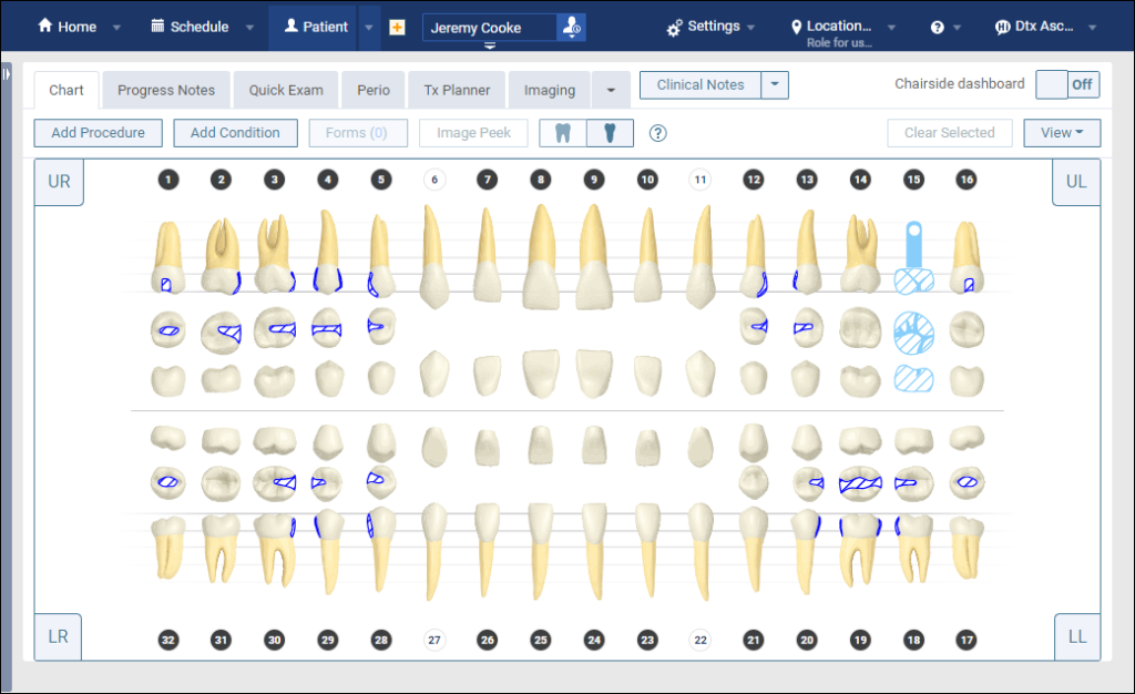 Seeing The Chart And The Perio Exam At The Same Time Dentrix Ascend